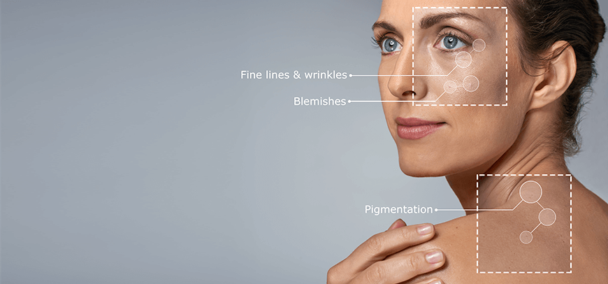 Aging-Skin